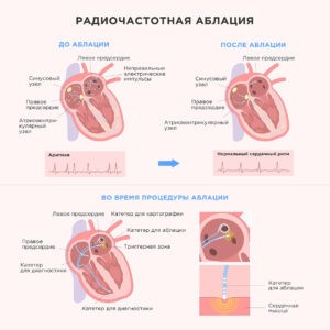 Потрясающий результат у женщины 85 лет