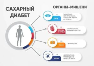 сахарный диабет
