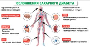 Хемохим исцеляет и восстанавливает Сахарный диабет