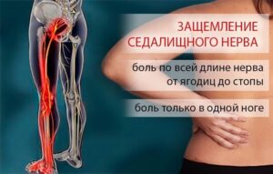 Середина декабря 2019 года, проблема с поясницей и далее невыносимая боль по всей правой ноге